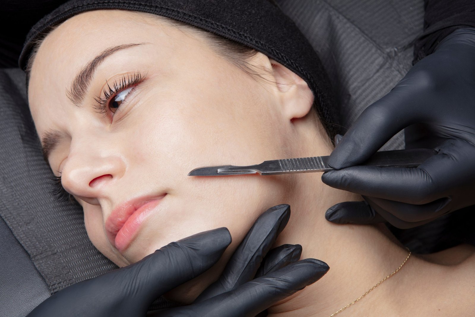 dermaplaning